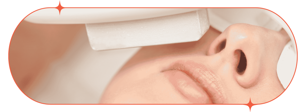 medical IPL hair removal