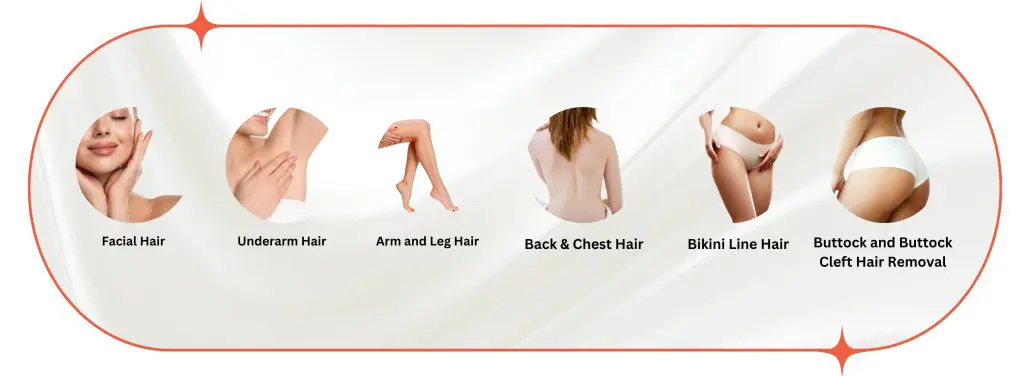 medical IPL hair removal
